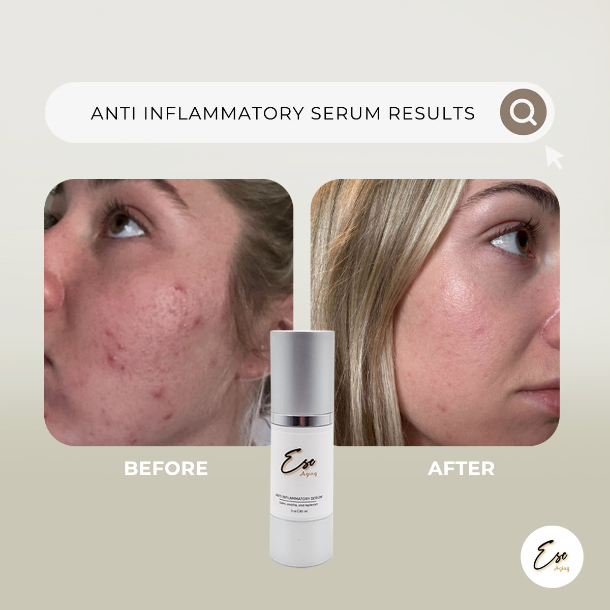 Anti-Inflammatory Serum Benefits